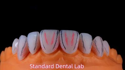Standard Dental Lab Co., Limited প্রস্তুতকারকের উৎপাদন লাইন