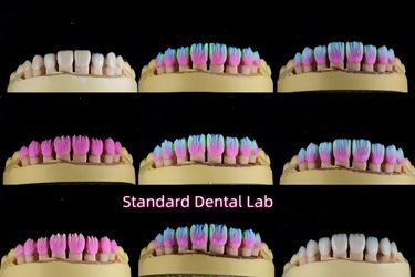 Standard Dental Lab Co., Limited প্রস্তুতকারকের উৎপাদন লাইন
