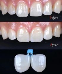 Standard Dental Lab Co., Limited প্রস্তুতকারকের উৎপাদন লাইন