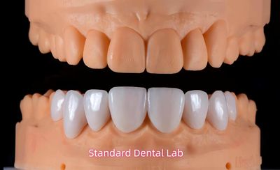 Standard Dental Lab Co., Limited প্রস্তুতকারকের উৎপাদন লাইন
