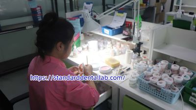 Standard Dental Lab Co., Limited প্রস্তুতকারকের উৎপাদন লাইন