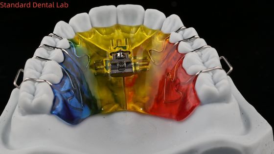 কেনা দাঁত সম্প্রসারণ এবং ডিস্টালাইজেশন Orthodontist গলা সম্প্রসারণকারী চীন ডেন্টাল ল্যাব অনলাইন উত্পাদন