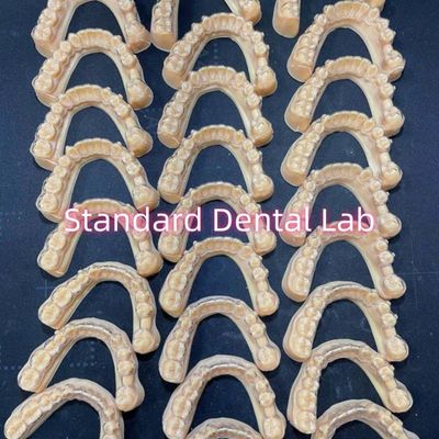 পেশাগত দাঁত দন্ত Orthodontic Invisalign পরিষ্কার সংরক্ষণকারী চিকিত্সা পরিকল্পনা