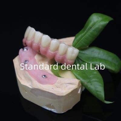 6 পূর্ণ Zirconia সেতু দাঁত উচ্চ নির্ভুলতা উপর Ti বেস উপর সব screwed