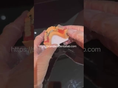 উচ্চ নান্দনিকতা স্বচ্ছ বন্ধনী এবং অ্যাক্রিলিক দাঁত সঙ্গে এক্রাইলিক আংশিক দাঁত China Dental Lab