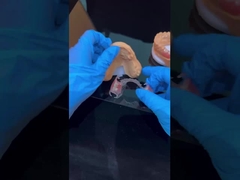 পরিষ্কার কাঠামো এক্রাইলিক ধাতু আংশিক দাঁত কাঠামো উচ্চ নান্দনিকতা চীন দাঁত ল্যাব