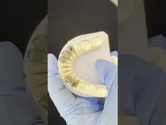 মেটাল কাস্ট পোস্ট কোর ক্রাউন কোকর সঠিক রিটেনটিভ ফুল জিরকোনিয়া ব্রুক্সিয়ার