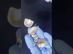 খুব ভাল স্টিকার সহ কাস্টমাইজযোগ্য কোবাল্ট ক্রোম কাস্ট ফ্রেম