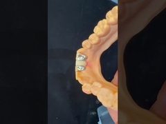 ডেন্টাল ডেন্টাল পিএফএম মেরিল্যান্ড ব্রিজ উচ্চ সৌন্দর্য FDA সার্টিফাইড