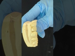 পূর্ণ কনট্যুর জিরকোনিয়া মুকুট/উচ্চ নান্দনিক প্রাকৃতিক কাস্টমাইজড এডাইট জিরকোনিয়া ডেন্টাল ব্রিজ