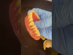 পূর্ণ উপরের এবং নীচের স্ট্যাপিপ্লেট এক্রাইলিক আংশিক দাঁত আইভোক্লার দাঁত গোলাপী গাম