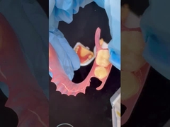 থ্রিডি প্রিন্ট মডেল উচ্চ নান্দনিকতা ডেন্টাল টিসিএস ভ্যালপ্লাস্ট নমনীয় আংশিক দাঁত দাঁত ল্যাব